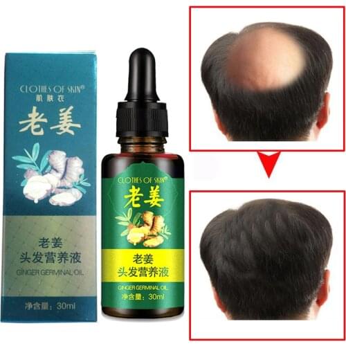 Hair Care Hair Growth Essential Oils Essence Original Authentic Hair Loss Health Care Beauty Dense Hair Growth Serum Ginger Oil
