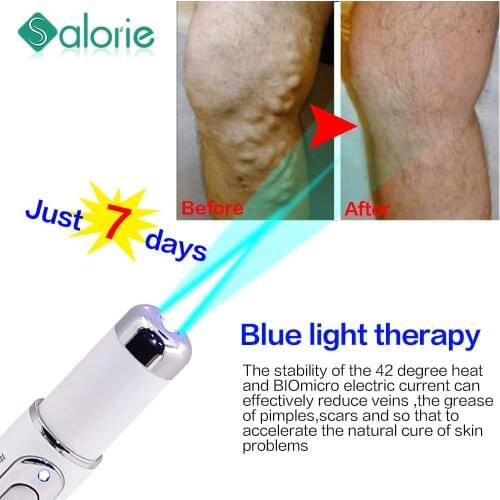 Portable Therapy Pen Wrinkle Scar Acne Remover Device Powerful Blue Light Spider Vein Blu-ray acne pen Eye Skin Care Tool