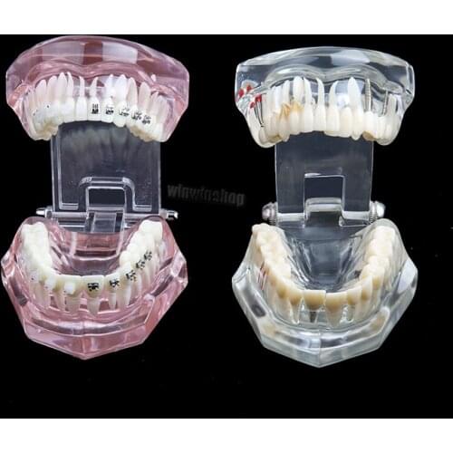 Dentist tooth human anatomy model classic repairable mobile learning model teaching resource for dental laboratory