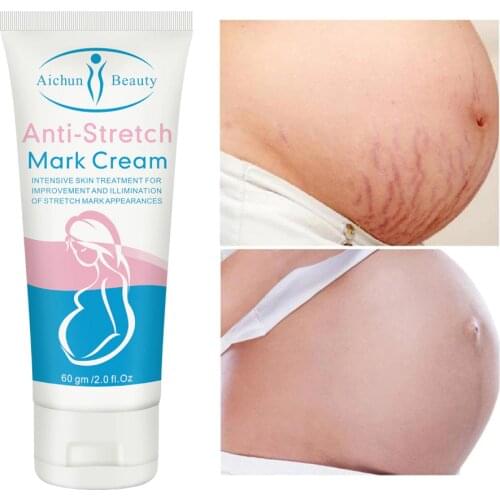 Remove Stretch Mark Cream Snail Extract Anti-fine lines Firming Skin Cream For Maternity Slackline Pregnant Cream