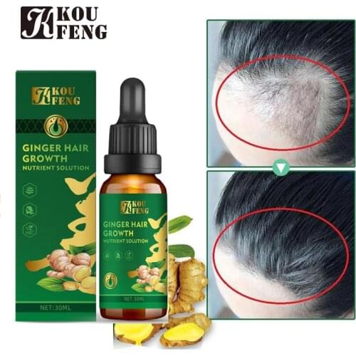 Hot 30ml Magic Fast Hair Growth Dense Regrowth Ginger Oil Anti Loss Treatment Essence Bin Wild Hair Growth Tools Hair Care