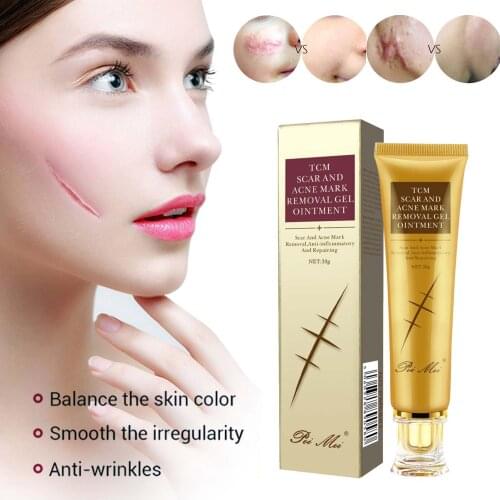 30g Acne Scar Removal Cream Pimples Stretch Marks Face Gel Remove Acne Smoothing Whitening Moisturizing Body Skin Care Aichun