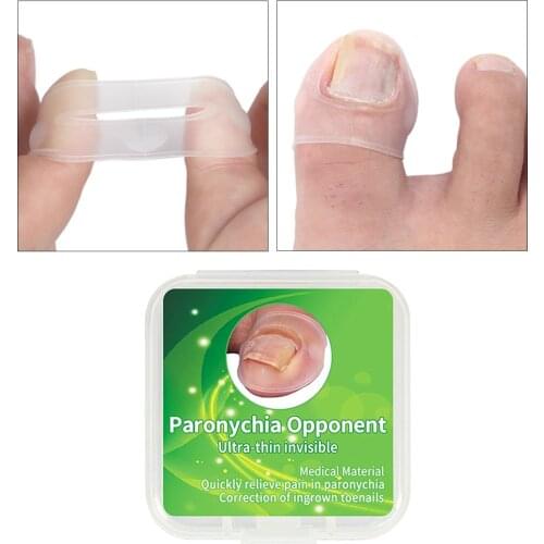 Clear Ingrown Toe Nail Repair Correction Corrector Sleeves Tool