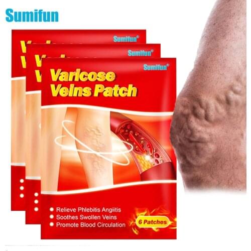 6pcs Varicose Veins Patch Leg Vasculitis Phlebitis Spider Anti-swelling Angiitis Removal Chinese Herbal Medical Plaster K06201