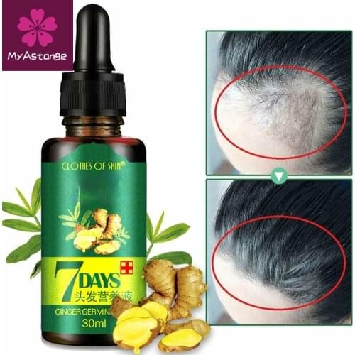 30ml 7 Days Ginger Essence Hairdressing Essential Oil 3pcs Hair Care Oil Essential Oil Dry Damaged Hairs Nutrition