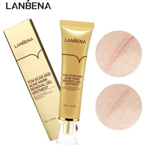 LANBENA Acne Scar Removal Cream Skin Repair Face Cream Improve Stretch Marks Acne Spots Acne-Treatment Gel Whitening Cream 30ml