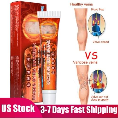 Hot Varicose Veins Treatment Cream Vasculitis Phlebitis Spider Leg Ointment Herb Plaster Angiitis Removal Patch Body Cream