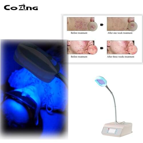 Medical Grade LED Photon Light Therapy Facial Body Beauty Machine Skin Rejuvenation Acne