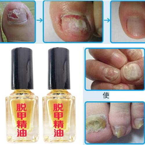 YIGANERJING Masks And Antiseptics
