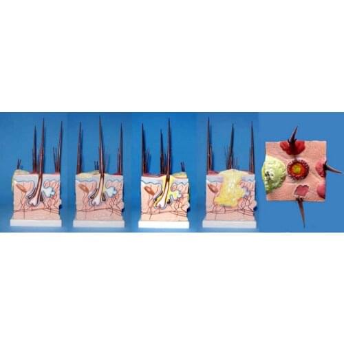 Dog skin Morbid state and normal skin model Compare Animal anatomy free shipping