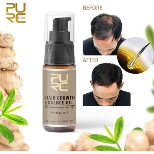 30ml/20ml 2019 New Hair Growth Spray Anti Hair Loss Hair Growth Spray Natural Hair Loss Products Conditioner Essential Oil TSLM1