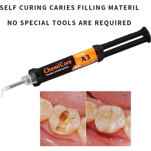 Caries Filling Material Tooth Repair Kit Self Curing Resin Teeth Cavity Restoration supplies Automix