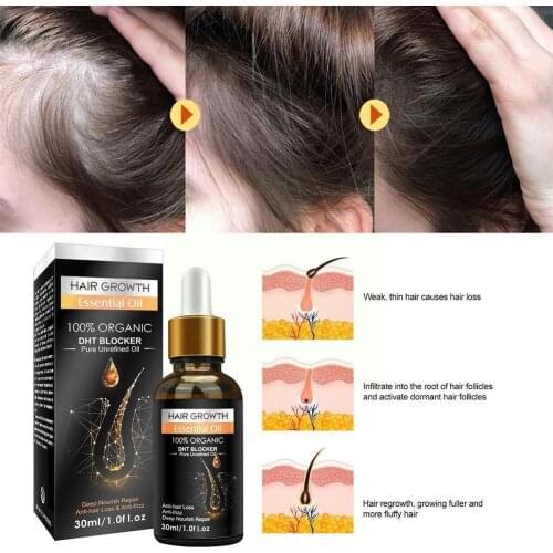 PEIMEI Hair Growth Treatment Serum Ginger Hair Essential Oil Ginger Dense Hair Restoration Care Growth Essence Hair Fast Gr Z0V9