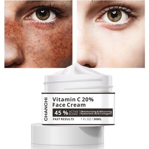 Vitamin C 20% Face Cream Whitening Remove Dark Spots Facial Gel Repair Fade Freckls Melanin Remover Brighten Skin Care