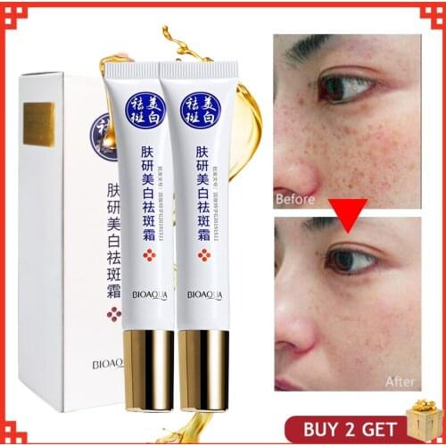 2 Boxes Whitening Face Cream Remove Freckle Melasma Facial Cream Acne Dark Black Skin Pigment Spots Lightening Skin Care