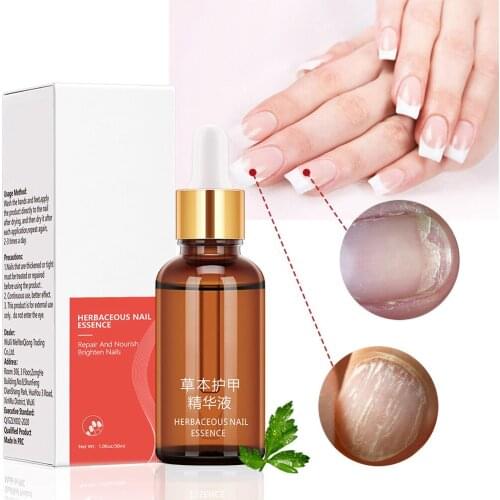 Fungus Nail Repair Cream Nail Fungus Treatment Feet Nail Care Foot Whitening Toe Nail Fungus Removal Gel Anti Infection