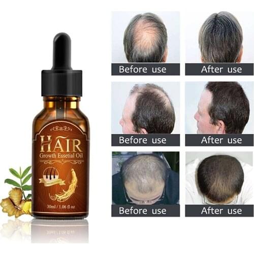 1pc Ginseng Essence Makeup Hair Care Treatment Men Women Hair Loss Fast Hair Growth Serum Maquiagem 30ml