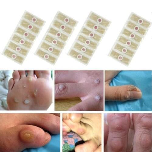 12pcs Medical plaster Foot Corn Removal Remover Warts Thorn Plaster Of Calluses Patch Callosity Detox Foot Pad Curative Plasters