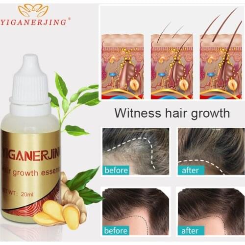 20ml Ginger Extract Dense Hair Fast Sunburst Hair Growth Essence Restoration Hair Loss Liquid Serum Hair Care Oil