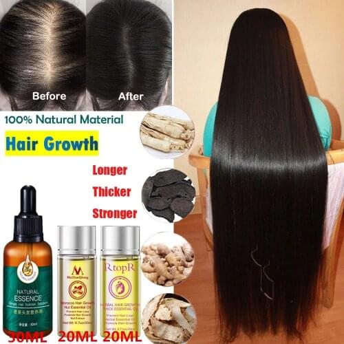 LANBENA Hair Growth Oils