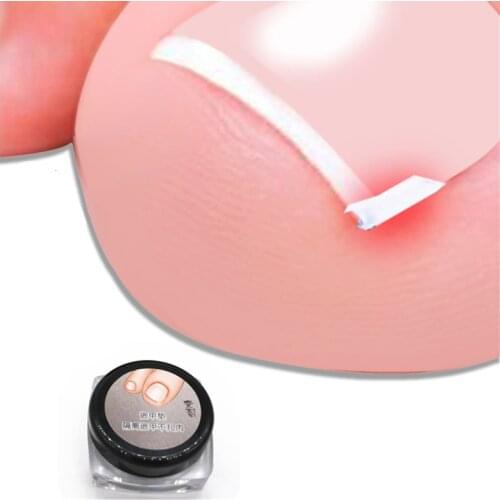 10pcs/set Ingrown Nail Pad Ortho Nail Filling Nail Groove Pad Ingrown toenail Corrector Feet Nail Care Tools Foot Care New