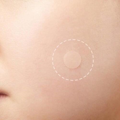 36/72PCS Acne Pimple Patch Invisible Acne Stickers Transparent Concealer Waterproof Hydrocolloid Beauty Tool Skin Care