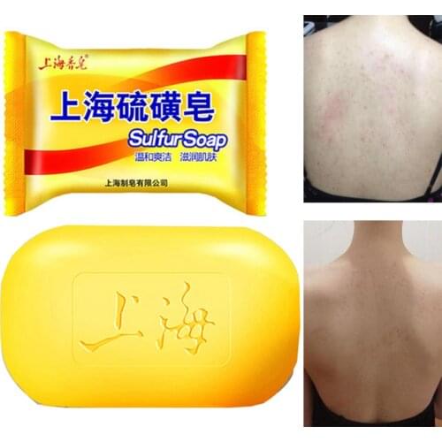 Shanghai Sulfur Soap Oil-Control Acne Treatment Blackhead Remover Soap 85g Whitening Cleanser Shrink Pores Skin Care