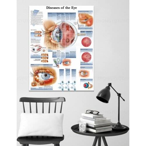 Canvas Poster Modern Home Decor Diseases of the Eye Print Painting Wall Art Medical Education Modular Picture For Living Room