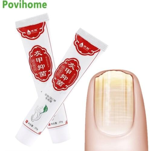20g Onychomycosis Anti Fungal Cream Natural Herbal Nail Repai Ointment Fingernails Toenail Remove Thick Gray Nail Repair Plaster