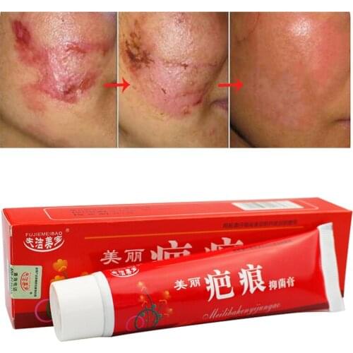 Scar Removal Cream Acne Scars Gel Stretch Marks Surgical Scar Burn For Body Pigmentation Corrector Acne Spots Repair Care 60g