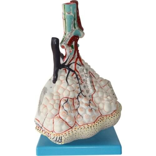 Pulmonary Lobe enlargement model Lung anatomy Lung lobules model Alveolar model
