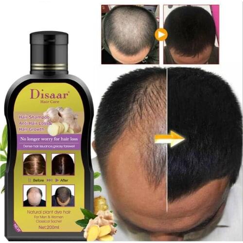 200ml Disaar Professional Anti-hair Loss Shampoo Preventing Chinese Loss Hair Treatment Hair Hair Product For Men Growth Wo Y6V6