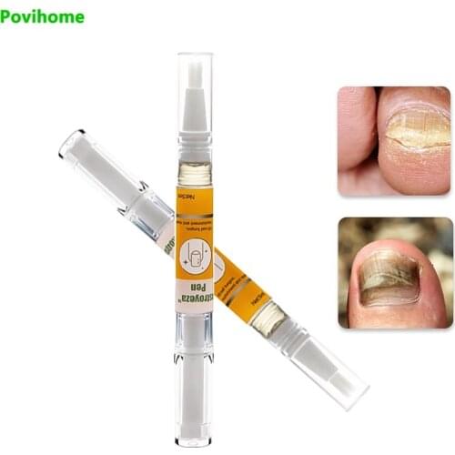 1pcs Nail Repair Gel Fungal Treatment Care Foot Nail Fungus Removal Gel Anti Infection Paronychia Onychomycosis Foot Whitening
