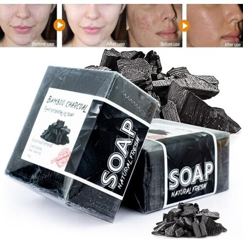Activated Charcoal Rose Handmade Soap Face Cleansing Whitening Soap Remove Acne Treatment Blackhead Oil Control Skin Care