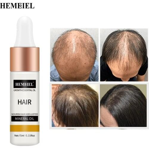 Hemeiel 15ML Anti Hair Lost Pure Essential Oil Women Man Hair Care treatement growing mineral oil regeneration Nourish Luster