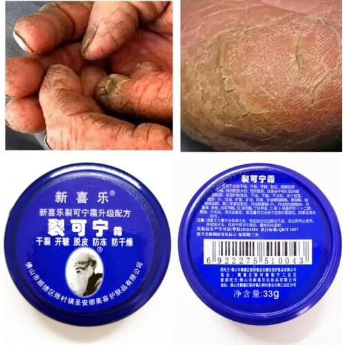 Anti Dry Crack Powerful Frozen Cracking Cream Prevent Repair Skin Dry Chapped Frozen Frostbite Chinese Medicinal Ointment 33g