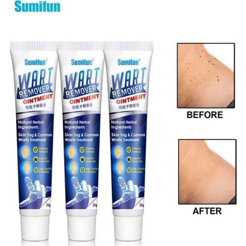 3pcs Sumifun Warts Remover Antibacterial Ointment Skin Tag Removal Treatment Cream Body Repair Chinese Tradition Plaster