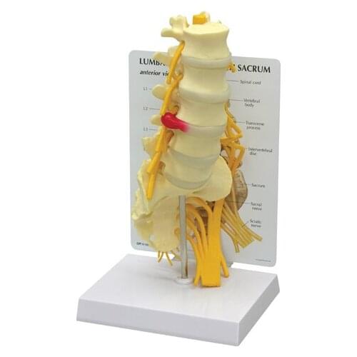 Lumbar model Spinal nerve model caudal equina nerve lumbar spine disc model Spine Chiropractic skeleton model