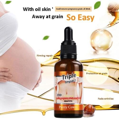 Stretch Marks Remover Essential Oil Skin Care Treatment Cream Anti-wrinkle Repair Cream Skin Care Removal Maternity Slackline