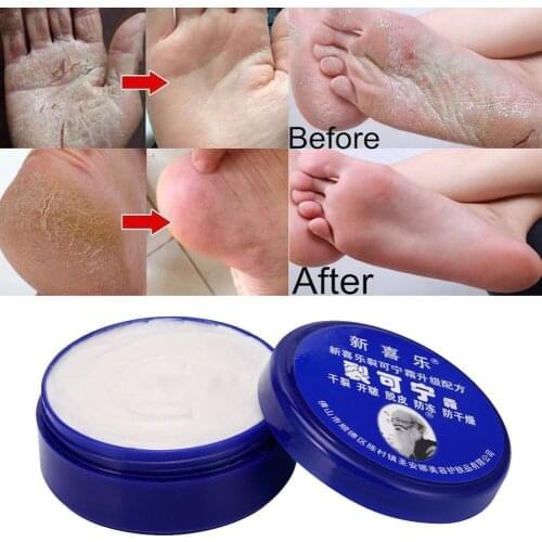 33/55gPowerful Traditional Chinese Anti-Drying Crack Repair Cream Feet Foot Cracked Removal Dead Care Hand Heel Skin Cream L8R9