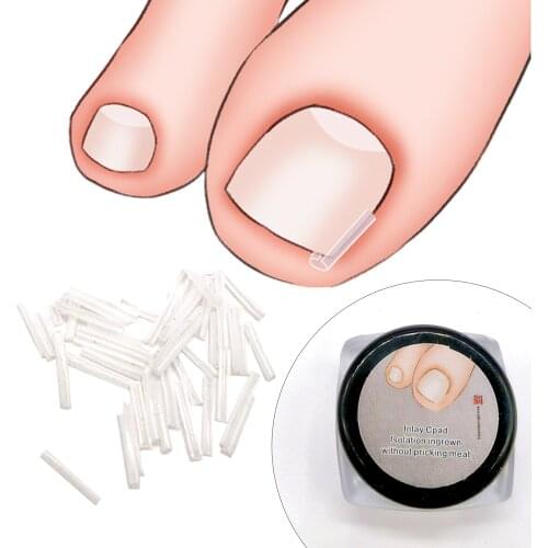 10pcs/set Ingrown Nail Pad Ortho Nail Filling Nail Groove Pad Ingrown toenail Corrector Feet Nail Care Tools Foot Care New