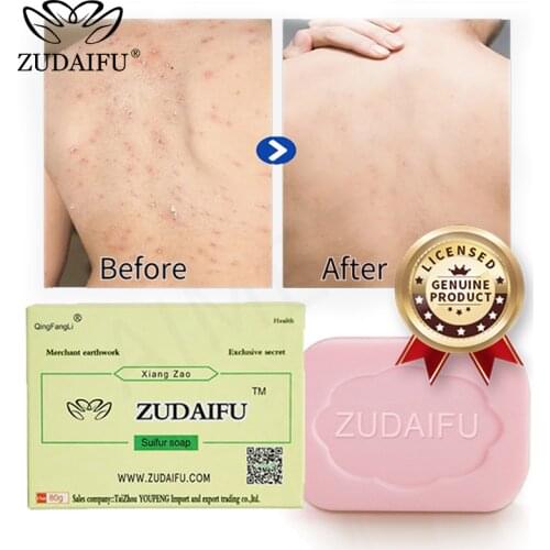 ZUDAIFU Sulfur soap natural Anti Fungus Perfume Butter Bubble Bath Healthy Soaps Skin