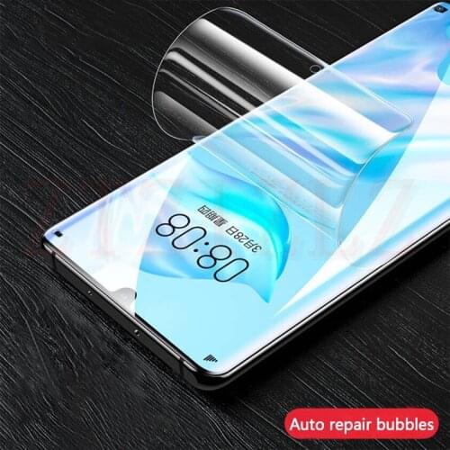 ZTZIZLZ Mobile Phone Accessories