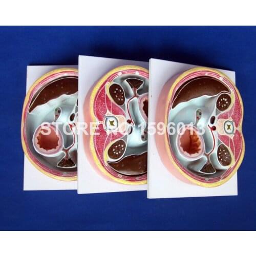 Cross Sectional Model of Abdominal Cavity,Peritoneal Transection Model,Abdominal Anatomy model