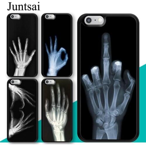 X-ray Hand Bones Case For iphone 11 12 Pro Max mini XR XS MAX X 5S SE 2020 6S 7 8 Plus Cover Coque