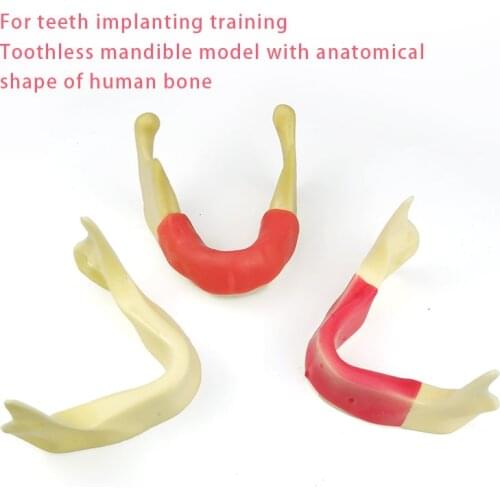 Dental Model Implant Practice Model Teeth Model Practice Teaching Studying Teeth Model