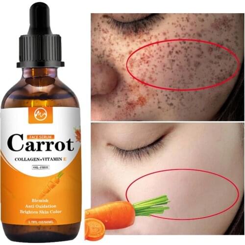 Minch Carrot Essence Dark Spot Corrector Face Whitening Serum Brighten Blemish Freckle Remover Natural Korea Skin Care Serum