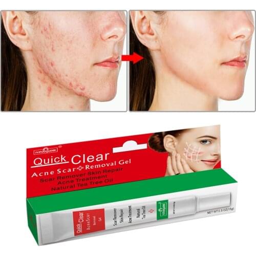 Natureguess Facial Care Products