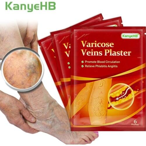 Newest 18pcs Varicose Veins Treatment Plaster 100% Original Vasculitis Phlebitis Spider Leg Pain Relief Patch Medical Plaster