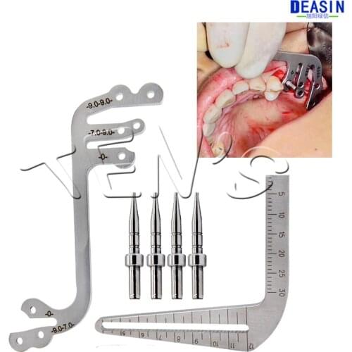 Dental Implant Locating Guide Planting Positioning Guide Implant Tools Planting Positioning Angle Ruler Dentist Tools